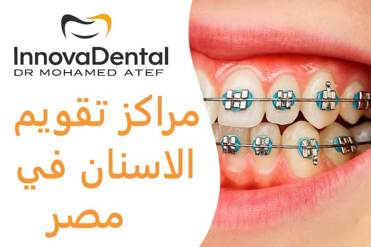 Orthodontic Centers In Egypt